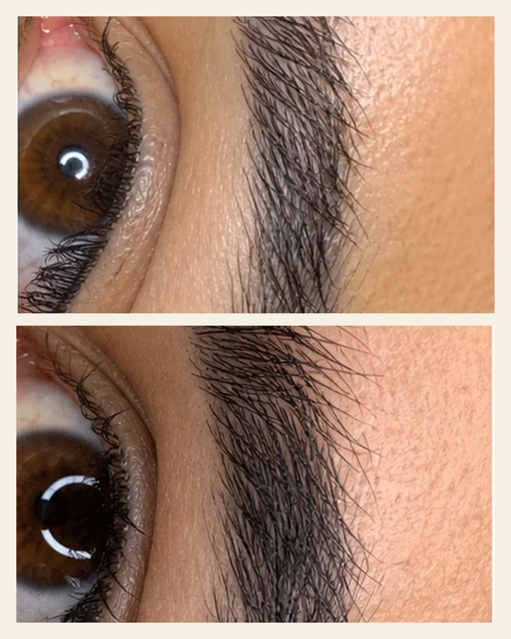 Avant après sourcils après plusieurs mois de protocole.