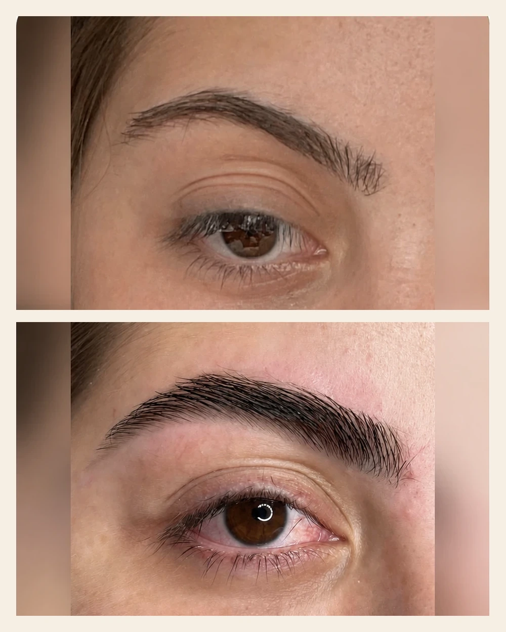 Avant après sourcils montrant une ligne mieux structurée après le protocole.